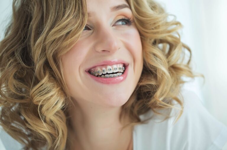 Braces Cost | Dentist Canberra