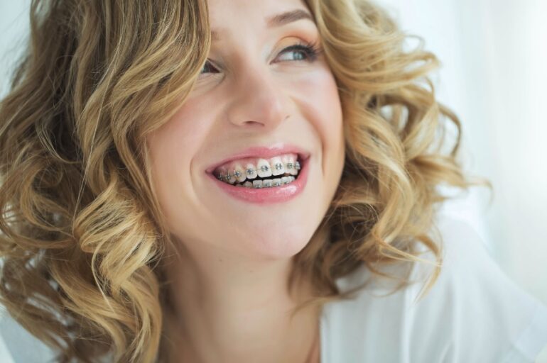 braces-cost-dentist-canberra