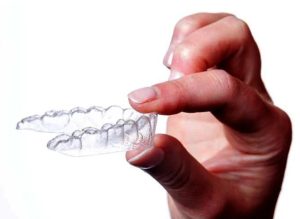 Invisalign Aligners