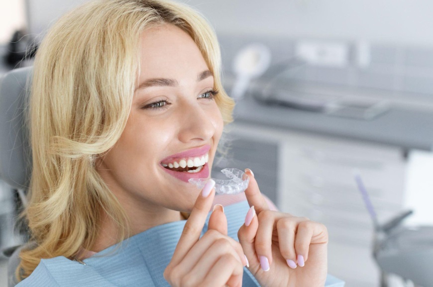 Invisalign Aligners