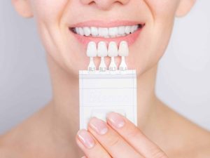 Veneer Teeth Price